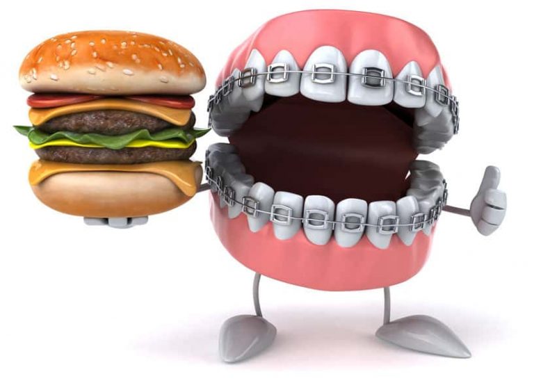 Can You Eat Burgers with Braces? | Perfect Patty Shaperz